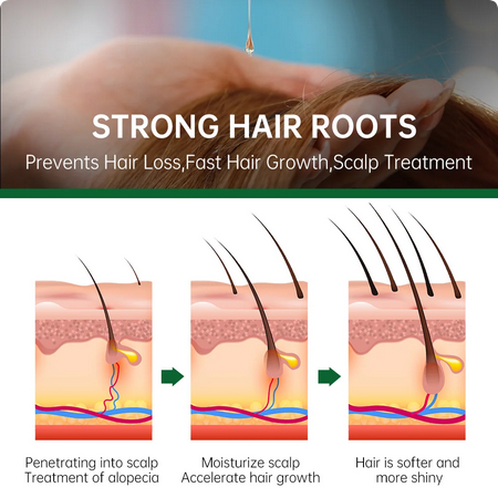 Rosemary Oil Hair Growth