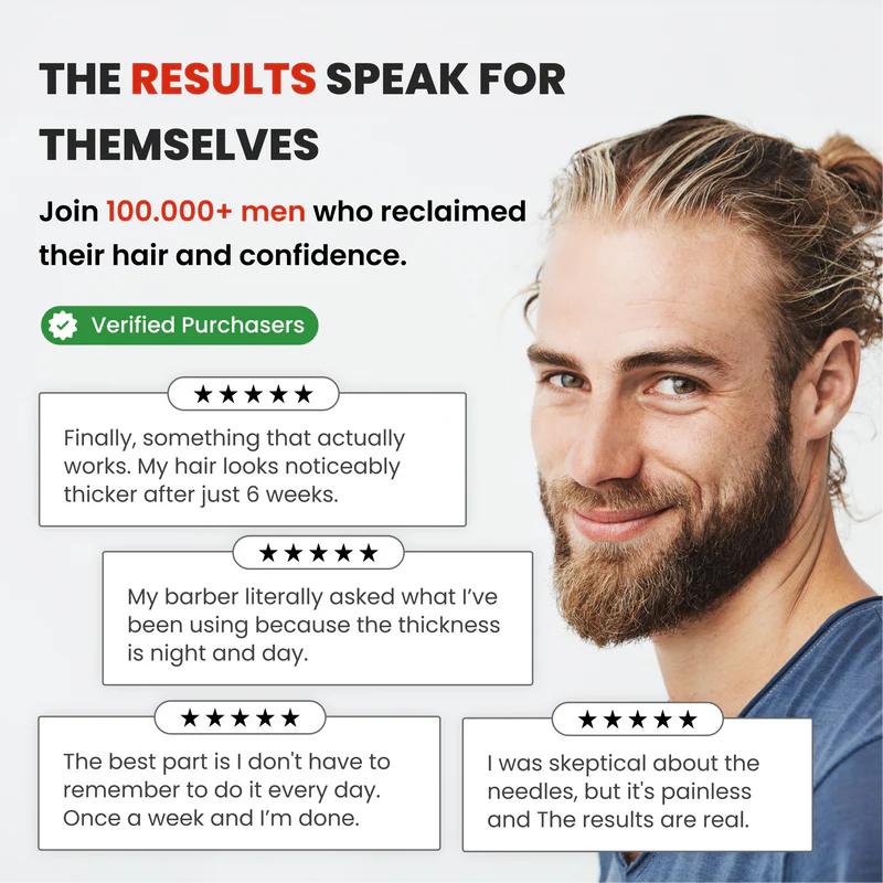 Hairline Renewal Micro-Infusion System